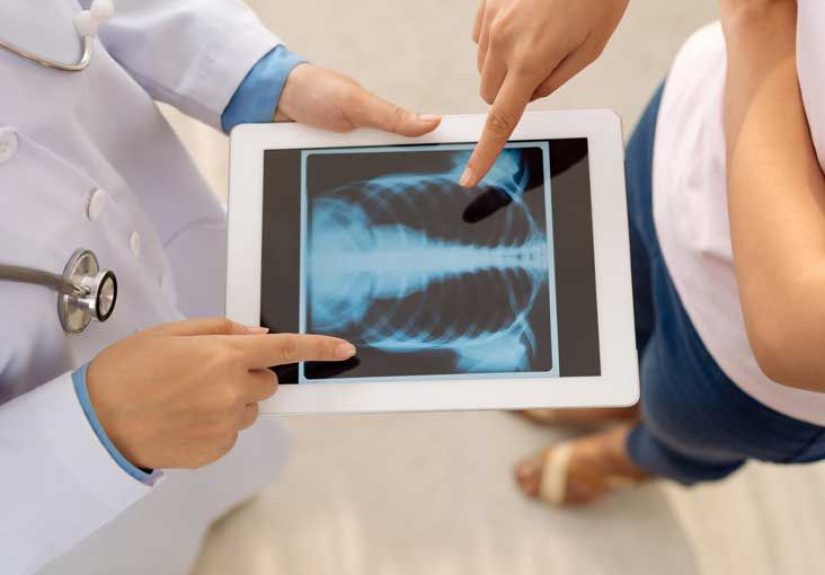 Lung Diffusion Testing: Purpose, Procedure, and Results
