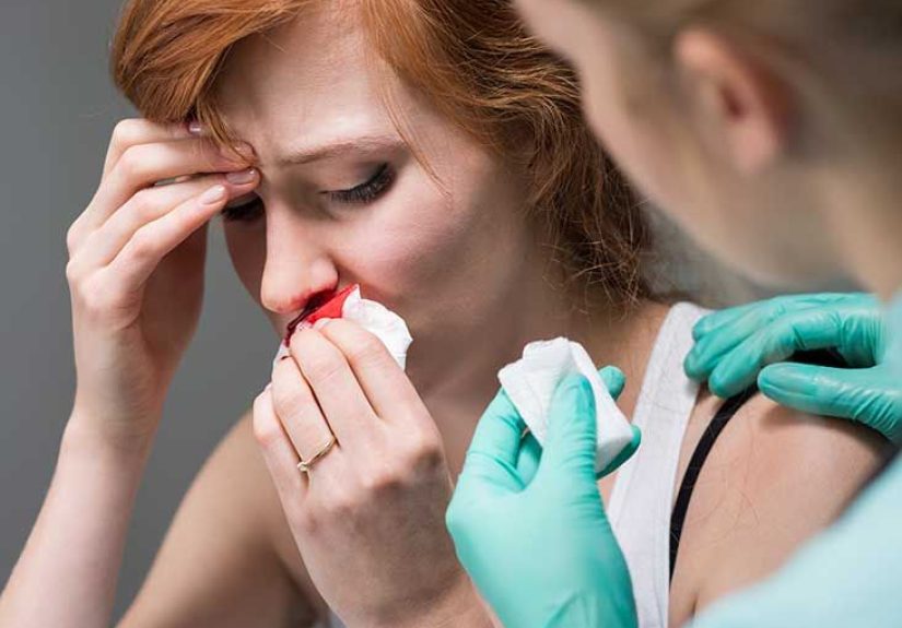 Osler-Weber-Rendu Disease: Causes, Symptoms & Diagnosis