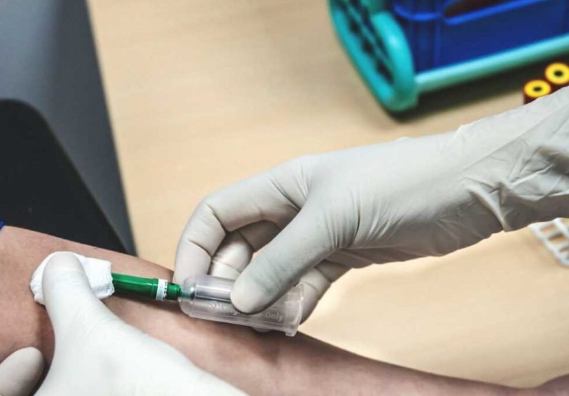 Testing for Metastatic Renal Cell Carcinoma