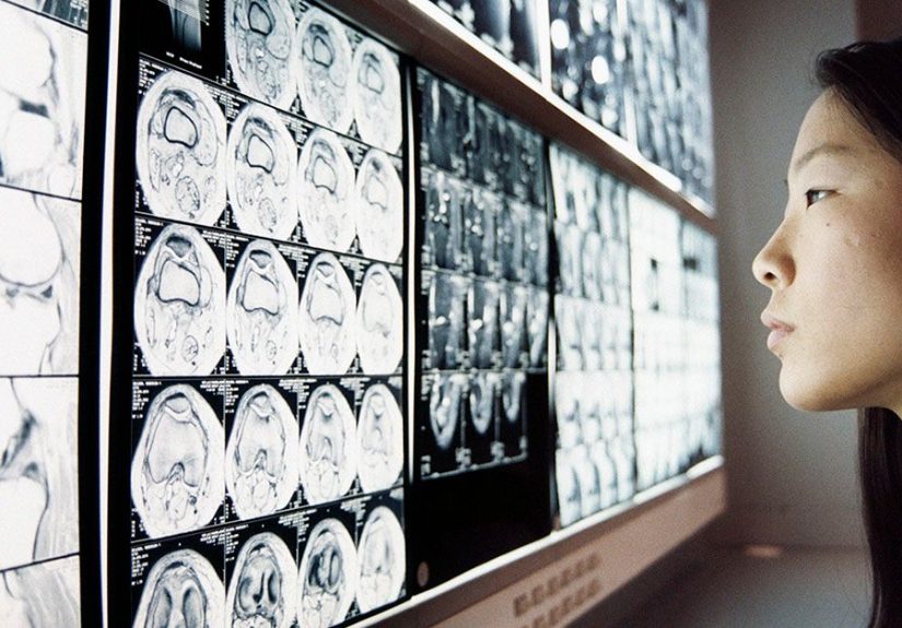 Types of scans: X-rays, CT, MRI, and more