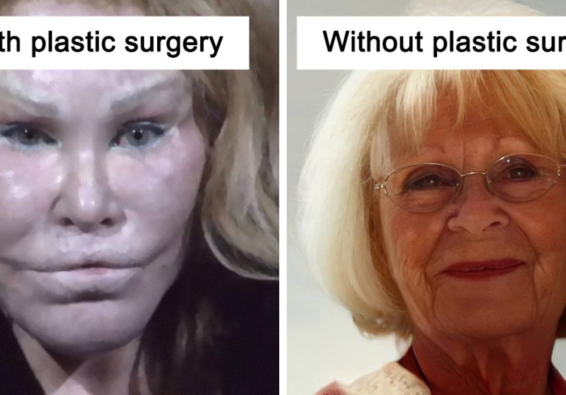 With The Help Of A.I., I Found Out What These Celebrities Would Look Like With No Plastic Surgery (21 Pics)