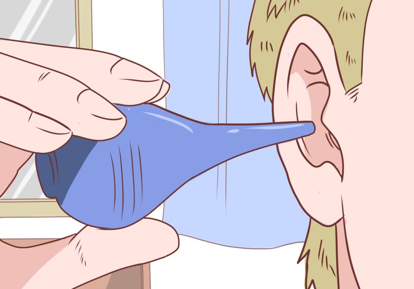 3 Ways to Deep Clean Your Ears