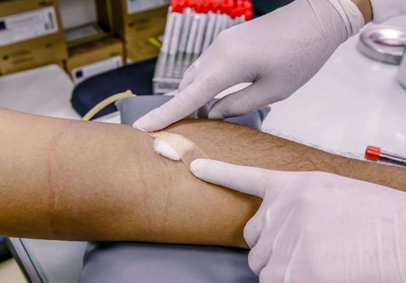 Bruising After Blood Draw: Why, What to Do, and Prevention