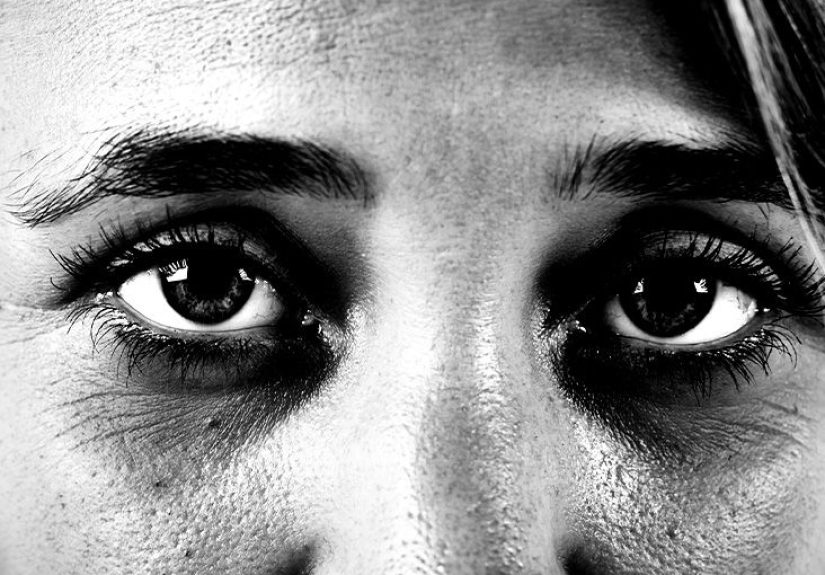 Dark circles under the eyes: Causes and treatments