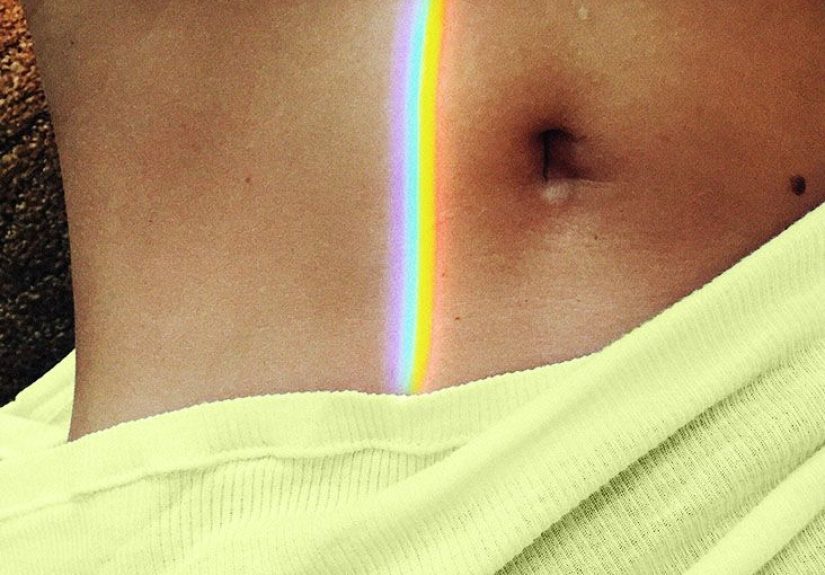 Eosinophilic colitis vs. ulcerative colitis: Differences