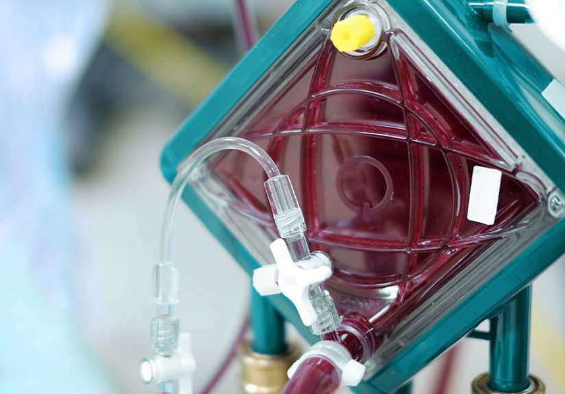 Extracorporeal Membrane Oxygenation (ECMO)