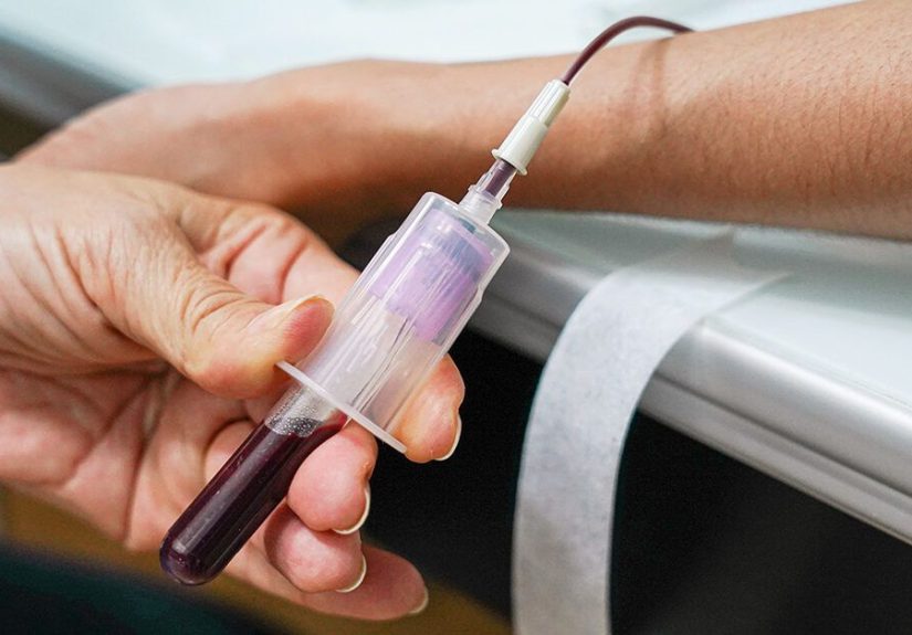 Grading of Immune and Chemotherapy-Induced Thrombocytopenia