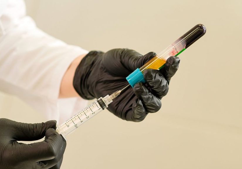 How Is Platelet-Rich Plasma Prepared?