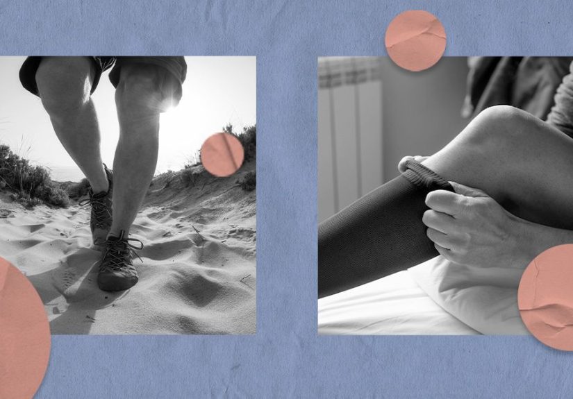 How to reverse venous insufficiency: Lifestyle and medical strategies