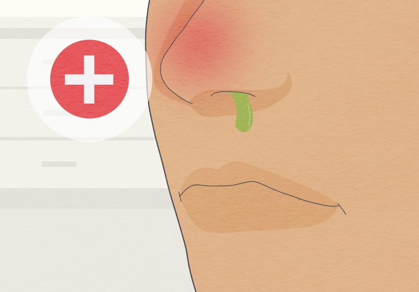 How to Sleep with a Stuffy Nose: 18 Tips and Home Remedies