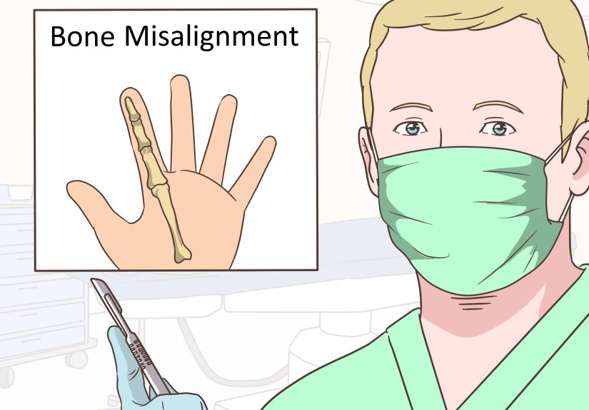 How to Treat Calluses on Your Hands and Feet: 14 Steps