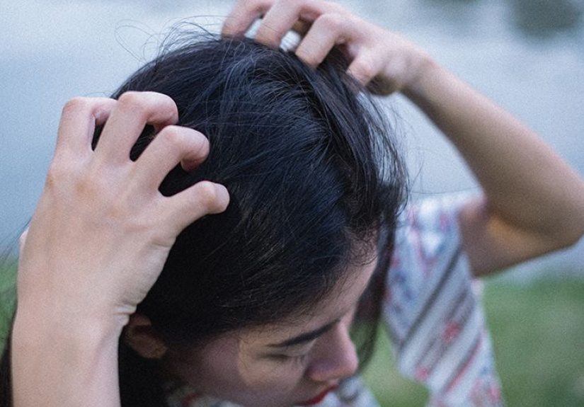 Itchy Scalp: Causes, Symptoms, and Treatment