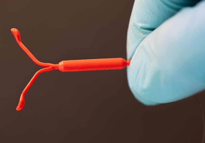 Long-Acting Reversible Contraception: Effectiveness and More