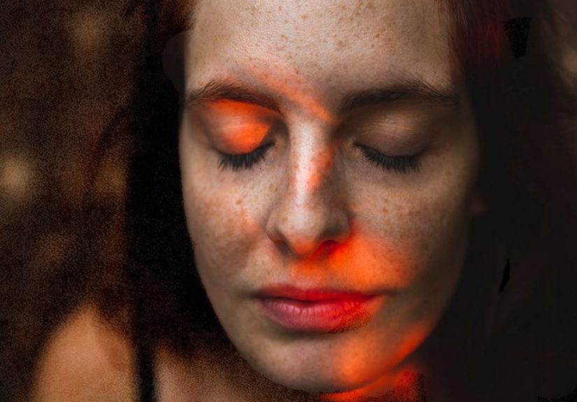 Psoriasis on the Face: Symptoms, Causes, and Treatments