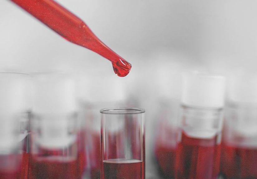 Thick blood: Causes, risk factors, symptoms, and treatment