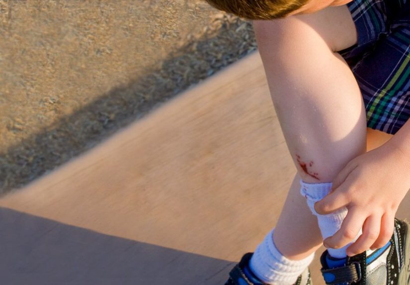 Why Do Scabs Itch? Causes and Treatments