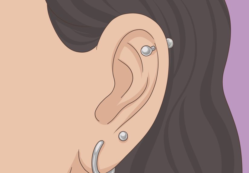 3 Easy Ways to Treat an Ear Piercing Infection Bump