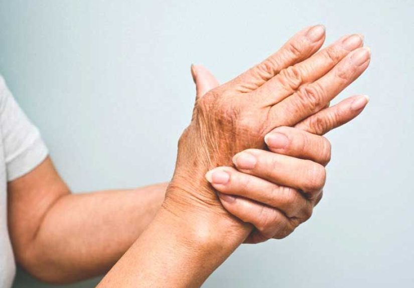 Artritis psoriásica: Tipos, síntomas, diagnóstico y más