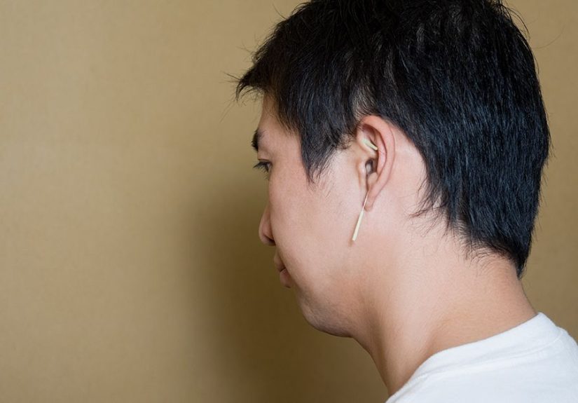 Auricular (Ear) Acupuncture: What it Can Help With