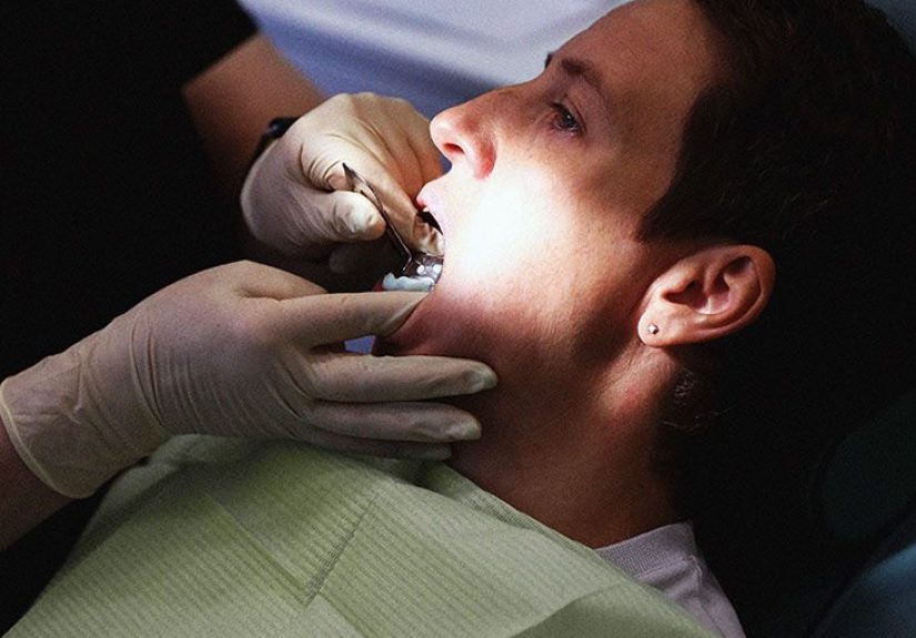 How to prevent dry socket: Methods, symptoms, and seeking help