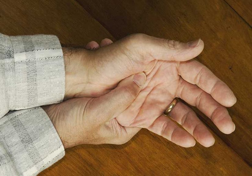 Psoriatic Arthritis Mutilans: Causes, Symptoms, and Treatment