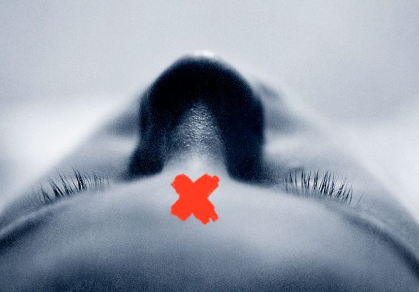 Sinus migraine: Definition, symptoms, treatment, and more