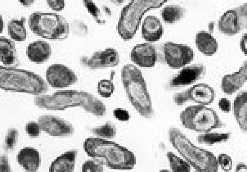 Walking Pneumonia: What It Is, Symptoms, Causes, and More