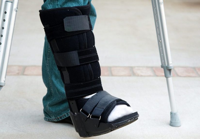 What to Know About Ankle Replacement Surgery