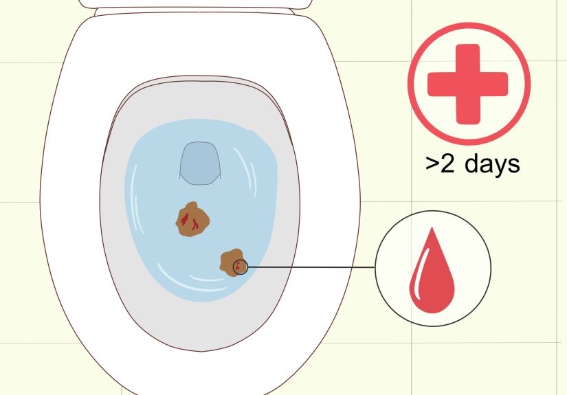 10 Ways to Naturally Treat Diarrhea During Pregnancy