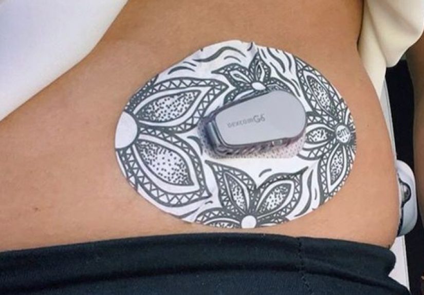 8 Great CGM and Insulin Pump Patches for People with Diabetes