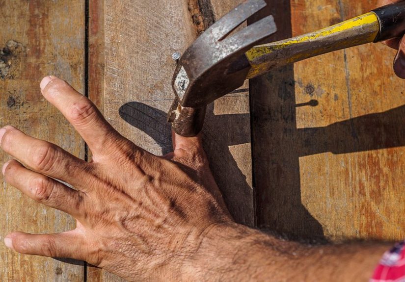 CoÃ¡gulo de sangre en el dedo: ImÃ¡genes, causas, tratamiento y mÃ¡s