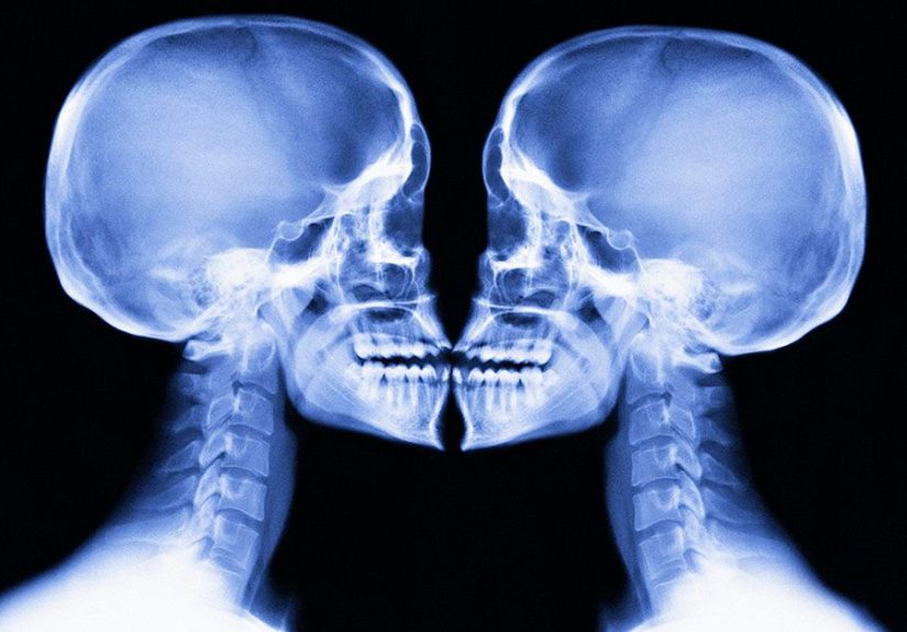 Disc desiccation: Symptoms, causes, and treatments