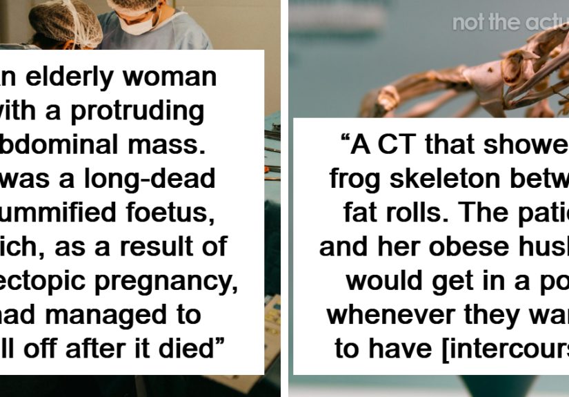 “Do Yourself A Favor And Don’t Google It”: 97 Medical Professionals Share The Most Shocking Things They’ve Seen In Human Bodies