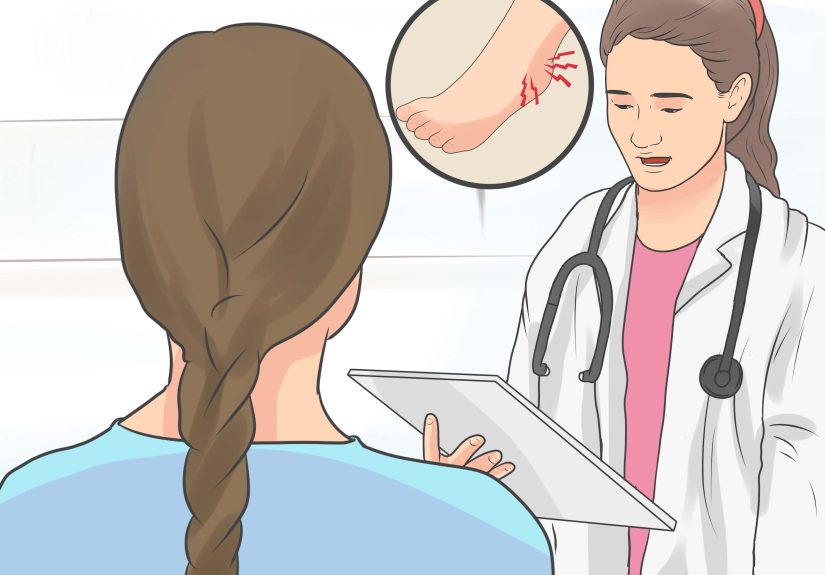 How to Recover From a Foot Injury