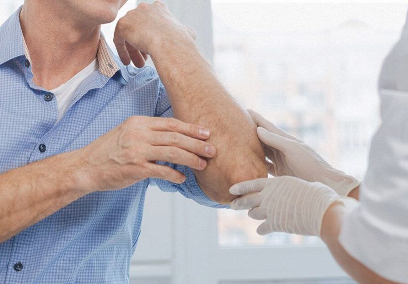 Is It Hives or Psoriasis? Learn the Signs