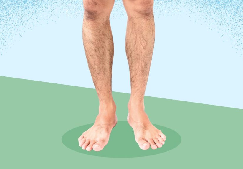 Leg Hair Loss: Causes and Effective Treatments