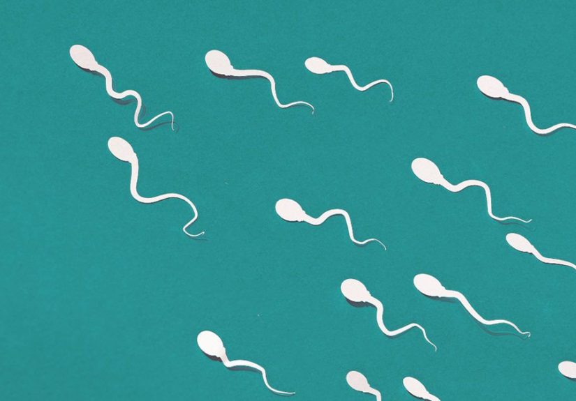 Low Sperm Count: Causes, Signs, Treatment, Pregnancy Chances