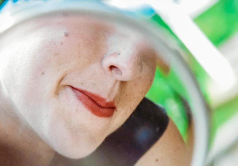 Mole Removal: Scar Chances, Care, and Pictures