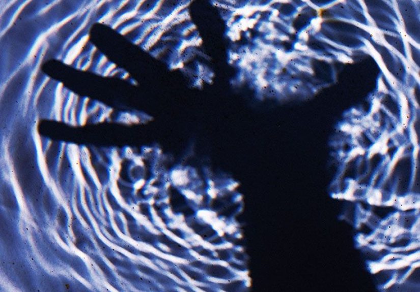 Russell's sign: Potential causes and when to call a doctor