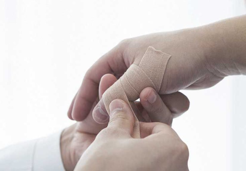 Sprained Thumb: Treatment, Recovery, Symptoms, and More