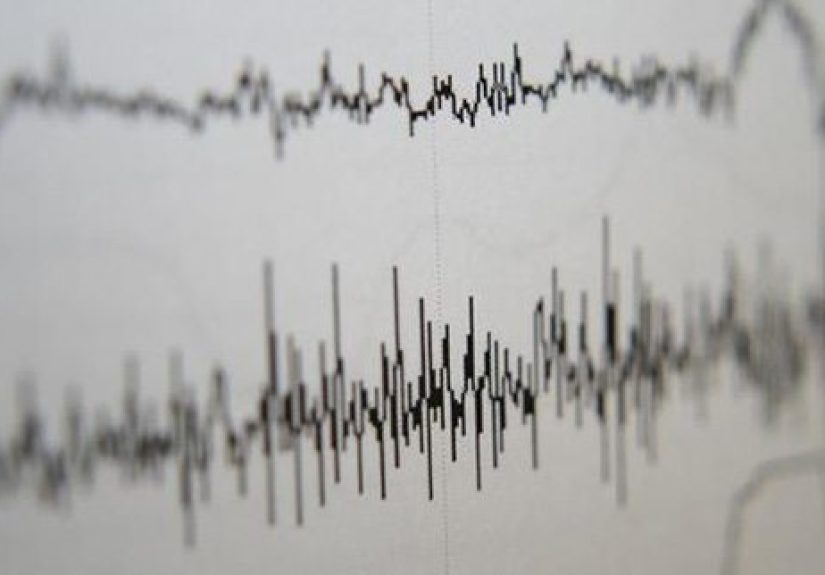 Top 10 Things to Know About Lie Detector Tests