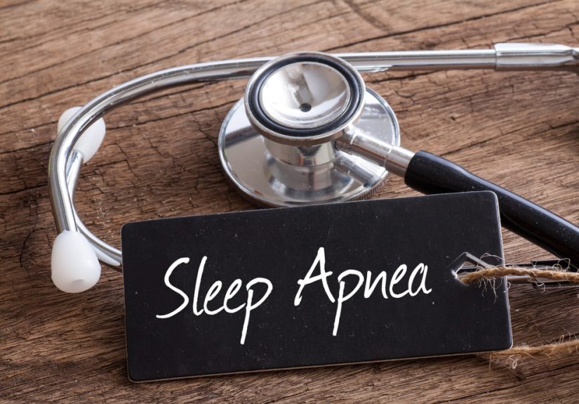 Treating Sleep Apnea Without CPAP