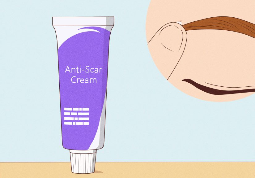 How to Avoid Eyebrow Piercing Scars: The Best Aftercare Tips