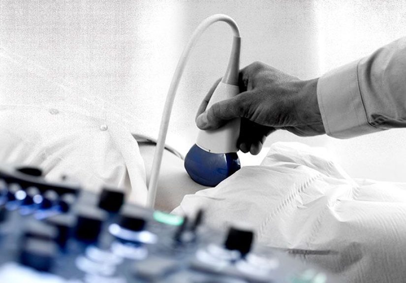 Ovarian Tumor Size: Does It Matter, Cancer Stage, and Treatment