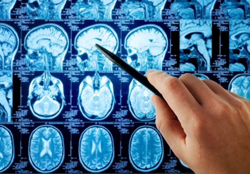 Should I Go Into Radiology? A Radiologist Gives Honest Answers.