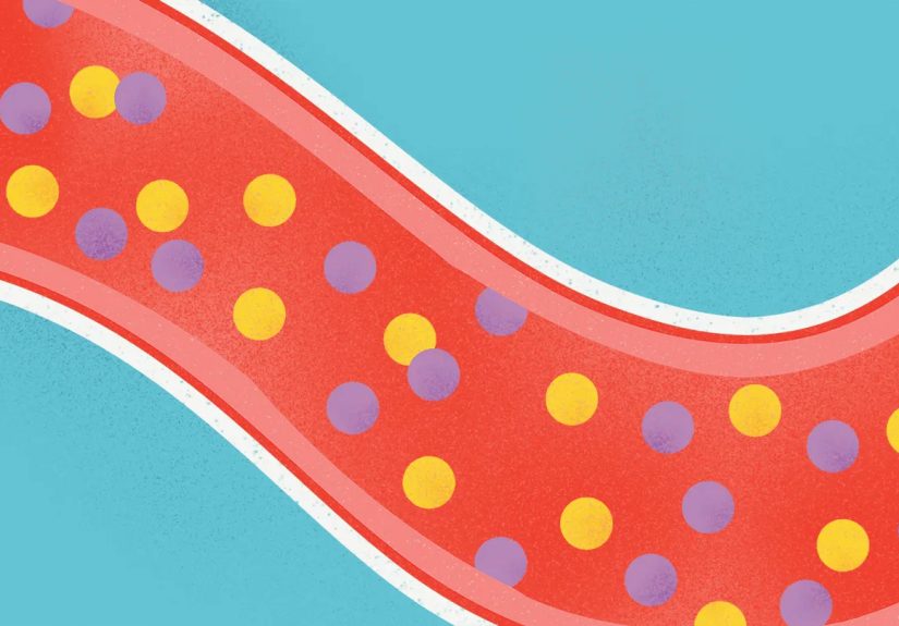 Triglycerides vs. Cholesterol: Key Differences and Health Tips