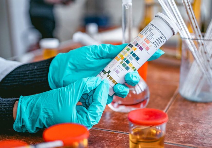 Urine pH Level Test: Purpose, Procedure, Results & More