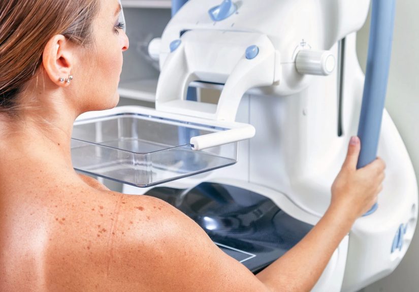 What Is Tomosynthesis for Breast Cancer Diagnosis?